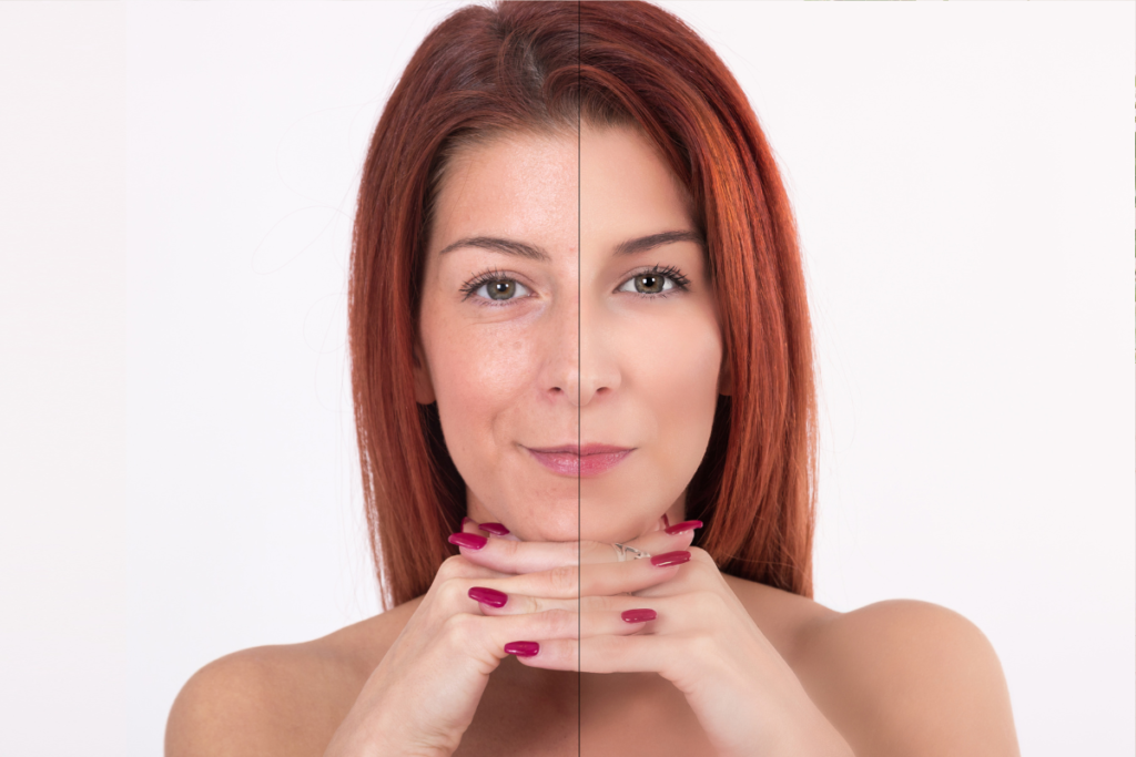 Improved skin elasticity and hydration